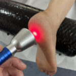 Laser Therapy: Find Local High-Intensity Specialists Today