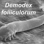 Demodex Mites: Link to Chronic Dry Eye Symptoms