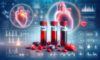 Cholesterol Blood Test: Your Essential Guide in Milton Keynes